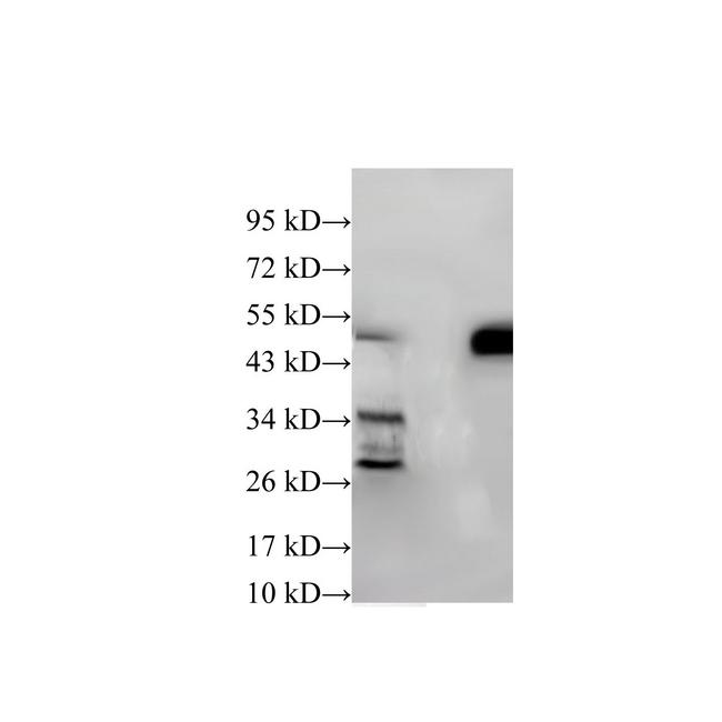 IFI44 Antibody - Western Blot analysis of Hela cells and Mouse kidney using IFI44 Polyclonal Antibody at dilution of 1:600.