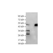 IFI44 Antibody - Western Blot analysis of Hela cells and Mouse kidney using IFI44 Polyclonal Antibody at dilution of 1:600.