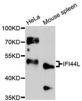 IFI44L Antibody - Western blot analysis of extracts of various cell lines, using IFI44L antibody at 1:3000 dilution. The secondary antibody used was an HRP Goat Anti-Rabbit IgG (H+L) at 1:10000 dilution. Lysates were loaded 25ug per lane and 3% nonfat dry milk in TBST was used for blocking. An ECL Kit was used for detection and the exposure time was 90s.