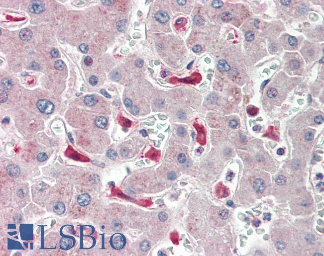IFI44L Antibody - Anti-IFI44L antibody IHC staining of human liver. Immunohistochemistry of formalin-fixed, paraffin-embedded tissue after heat-induced antigen retrieval. Antibody concentration 10 ug/ml.  This image was taken for the unconjugated form of this product. Other forms have not been tested.