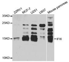 IFI6 / G1P3 Antibody - Western blot analysis of extracts of various cell lines.