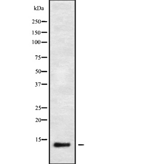 IFI6 / G1P3 Antibody - Western blot analysis IFI6 using HeLa whole cells lysates