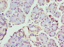 IFIH1 / MDA5 Antibody - Immunohistochemistry of paraffin-embedded human pancreas using antibody at 1:100 dilution.