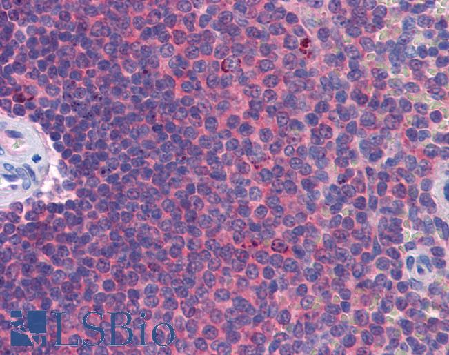 IFIH1 / MDA5 Antibody - Anti-MDA5 antibody IHC of human spleen. Immunohistochemistry of formalin-fixed, paraffin-embedded tissue after heat-induced antigen retrieval. Antibody concentration 5 ug/ml.  This image was taken for the unconjugated form of this product. Other forms have not been tested.