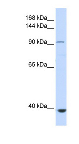 IFIH1 / MDA5 Antibody - IFIH1 / MDA5 antibody Western blot of Fetal Muscle lysate. This image was taken for the unconjugated form of this product. Other forms have not been tested.