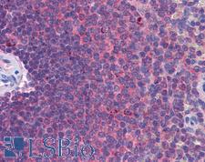 IFIH1 / MDA5 Antibody - Anti-MDA5 antibody IHC of human spleen. Immunohistochemistry of formalin-fixed, paraffin-embedded tissue after heat-induced antigen retrieval. Antibody concentration 5 ug/ml.  This image was taken for the unconjugated form of this product. Other forms have not been tested.