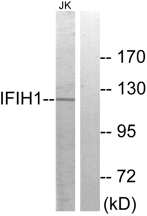 IFIH1 / MDA5 Antibody - Western blot analysis of lysates from Jurkat cells, using IFIH1 Antibody. The lane on the right is blocked with the synthesized peptide.