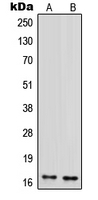 IFIH1 / MDA5 Antibody - Western blot analysis of MDA5 expression in HepG2 (A); THP1 (B) whole cell lysates.