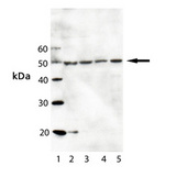 IFIH1 / MDA5 Antibody - Western blot of MDA5: Lane 1: MW Marker; Lane 2: HeLa; Lane 3: A431; Lane 4: L929; Lane 5: 3T3