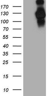 IFIH1 / MDA5 Antibody - HEK293T cells were transfected with the pCMV6-ENTRY control. (Left lane) or pCMV6-ENTRY IFIH1. (Right lane) cDNA for 48 hrs and lysed. Equivalent amounts of cell lysates. (5 ug per lane) were separated by SDS-PAGE and immunoblotted with anti-IFIH1. (1:2000)