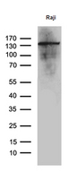 IFIH1 / MDA5 Antibody - Western blot analysis of extracts. (35ug) from RAJI cell line by using anti-IFIH1 monoclonal antibody. (1:500)