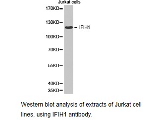 IFIH1 / MDA5 Antibody - Western blot.