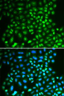 IFIH1 / MDA5 Antibody - Immunofluorescence analysis of A549 cells.
