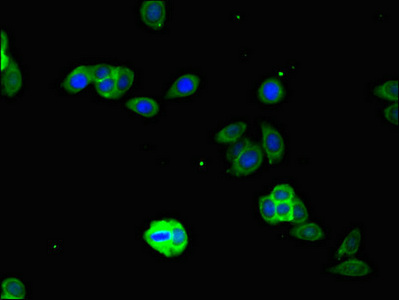 IFIH1 / MDA5 Antibody - Immunofluorescent analysis of HepG2 cells using IFIH1 Antibody at dilution of 1:100 and Alexa Fluor 488-congugated AffiniPure Goat Anti-Rabbit IgG(H+L)