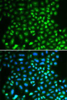 IFIH1 / MDA5 Antibody - Immunofluorescence analysis of A549 cells using IFIH1 antibody. Blue: DAPI for nuclear staining.