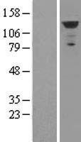 IFIH1 / MDA5 Protein - Western validation with an anti-DDK antibody * L: Control HEK293 lysate R: Over-expression lysate