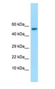 IFIT1 / ISG56 Antibody - IFIT1 / ISG56 antibody Western Blot of Fetal Stomach.  This image was taken for the unconjugated form of this product. Other forms have not been tested.