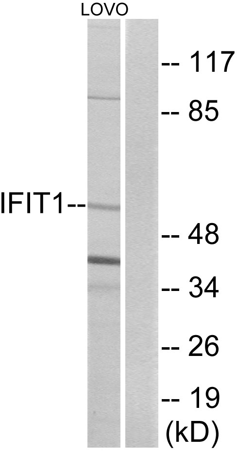 IFIT1 / ISG56 Antibody - Western blot analysis of lysates from LOVO cells, using IFIT1 Antibody. The lane on the right is blocked with the synthesized peptide.