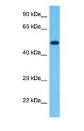 IFIT1 / ISG56 Antibody - Western blot of IFIT1 Antibody with human Fetal Kidney lysate.  This image was taken for the unconjugated form of this product. Other forms have not been tested.