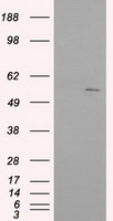 IFIT1 / ISG56 Antibody - HEK293T cells were transfected with the pCMV6-ENTRY control (Left lane) or pCMV6-ENTRY IFIT1 (Right lane) cDNA for 48 hrs and lysed. Equivalent amounts of cell lysates (5 ug per lane) were separated by SDS-PAGE and immunoblotted with anti-IFIT1.