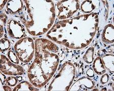 IFIT1 / ISG56 Antibody - IHC of paraffin-embedded Human Kidney tissue using anti-IFIT1 mouse monoclonal antibody.