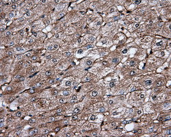 IFIT1 / ISG56 Antibody - IHC of paraffin-embedded Human liver tissue using anti-IFIT1 mouse monoclonal antibody.