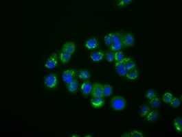 IFIT1 / ISG56 Antibody - Immunofluorescent staining of HT29 cells using anti-IFIT1 mouse monoclonal antibody.