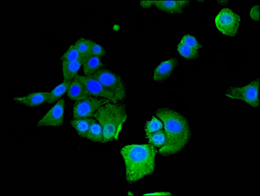 IFIT1 / ISG56 Antibody - Immunofluorescent analysis of HepG2 cells using IFIT1 Antibody at a dilution of 1:100 and Alexa Fluor 488-congugated AffiniPure Goat Anti-Rabbit IgG(H+L)