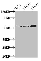 IFIT1 / ISG56 Antibody - Western Blot Positive WB detected in: Hela whole cell lysate, Rat liver tissue, Mouse liver tissue All lanes: IFIT1 antibody at 4µg/ml Secondary Goat polyclonal to rabbit IgG at 1/50000 dilution Predicted band size: 56, 52 kDa Observed band size: 56 kDa