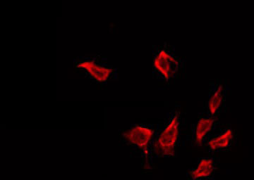 IFIT1 / ISG56 Antibody - Staining LOVO cells by IF/ICC. The samples were fixed with PFA and permeabilized in 0.1% Triton X-100, then blocked in 10% serum for 45 min at 25°C. The primary antibody was diluted at 1:200 and incubated with the sample for 1 hour at 37°C. An Alexa Fluor 594 conjugated goat anti-rabbit IgG (H+L) Ab, diluted at 1/600, was used as the secondary antibody.