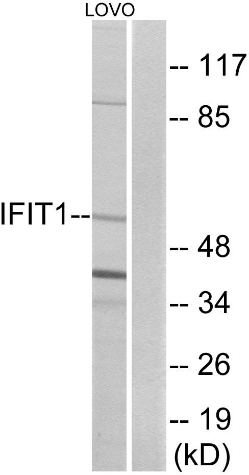 IFIT1 / ISG56 Antibody - Western blot analysis of extracts from LOVO cells, using IFIT1 antibody.