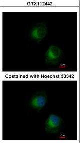 IFIT3 Antibody - Immunofluorescence of methanol-fixed HeLa using IFIT3 antibody at 1:500 dilution.