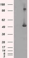 IFIT3 Antibody - HEK293T cells were transfected with the pCMV6-ENTRY control (Left lane) or pCMV6-ENTRY IFIT3 (Right lane) cDNA for 48 hrs and lysed. Equivalent amounts of cell lysates (5 ug per lane) were separated by SDS-PAGE and immunoblotted with anti-IFIT3.