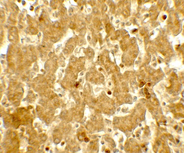 IFIT3 Antibody - Immunohistochemistry of IFIT3 in human liver tissue with IFIT3 antibody at 5 ug/mL.