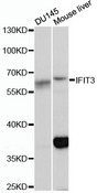 IFIT3 Antibody - Western blot analysis of extracts of various cell lines, using IFIT3 antibody at 1:1000 dilution. The secondary antibody used was an HRP Goat Anti-Rabbit IgG (H+L) at 1:10000 dilution. Lysates were loaded 25ug per lane and 3% nonfat dry milk in TBST was used for blocking. An ECL Kit was used for detection and the exposure time was 5s.