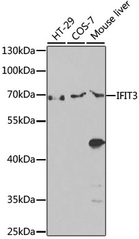 IFIT3 Antibody - Western blot analysis of extracts of various cell lines, using IFIT3 antibody at 1:1000 dilution. The secondary antibody used was an HRP Goat Anti-Rabbit IgG (H+L) at 1:10000 dilution. Lysates were loaded 25ug per lane and 3% nonfat dry milk in TBST was used for blocking. An ECL Kit was used for detection and the exposure time was 90s.