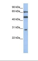 IFIT5 Antibody - Jurkat cell lysate. Antibody concentration: 1.0 ug/ml. Gel concentration: 12%.  This image was taken for the unconjugated form of this product. Other forms have not been tested.