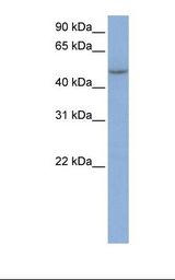 IFIT5 Antibody - MCF7 cell lysate. Antibody concentration: 1.0 ug/ml. Gel concentration: 12%.  This image was taken for the unconjugated form of this product. Other forms have not been tested.
