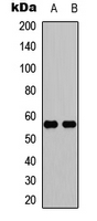 IFIT5 Antibody - Western blot analysis of IFIT5 expression in Jurkat (A); mouse lung (B) whole cell lysates.
