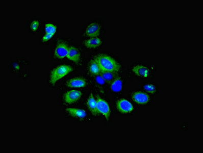 IFIT5 Antibody - Immunofluorescent analysis of HepG2 cells using IFIT5 Antibody at dilution of 1:100 and Alexa Fluor 488-congugated AffiniPure Goat Anti-Rabbit IgG(H+L)