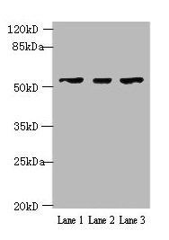 IFIT5 Antibody - Western blot All lanes: IFIT5 antibody at 2µg/ml Lane 1: A375 whole cell lysate Lane 2: Jurkat whole cell lysate Lane 3: HepG2 whole cell lysate Secondary Goat polyclonal to rabbit IgG at 1/10000 dilution Predicted band size: 56, 51 kDa Observed band size: 56 kDa