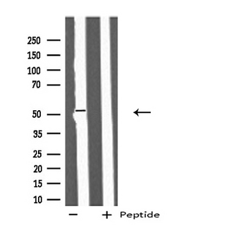 IFIT5 Antibody - Western blot analysis of extracts of Jurkat cells using IFIT5 antibody.