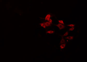 IFIT5 Antibody - Staining HeLa cells by IF/ICC. The samples were fixed with PFA and permeabilized in 0.1% Triton X-100, then blocked in 10% serum for 45 min at 25°C. The primary antibody was diluted at 1:200 and incubated with the sample for 1 hour at 37°C. An Alexa Fluor 594 conjugated goat anti-rabbit IgG (H+L) antibody, diluted at 1/600, was used as secondary antibody.