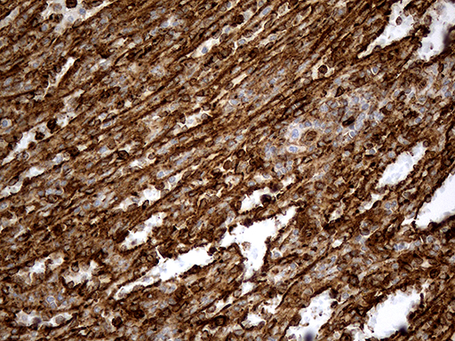 IFITM2 Antibody - Immunohistochemical staining of paraffin-embedded Human spleen tissue within the normal limits using anti-IFITM2 mouse monoclonal antibody. (Heat-induced epitope retrieval by 1mM EDTA in 10mM Tris buffer. (pH8.5) at 120°C for 3 min. (1:500)