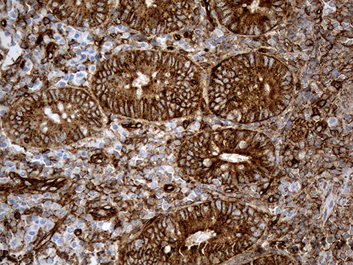 IFITM2 Antibody - Immunohistochemical staining of paraffin-embedded Human appendix tissue within the normal limits using anti-IFITM2 mouse monoclonal antibody. (Heat-induced epitope retrieval by 1mM EDTA in 10mM Tris buffer. (pH8.5) at 120°C for 3 min. (1:500)