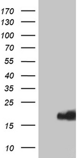 IFITM2 Antibody - HEK293T cells were transfected with the pCMV6-ENTRY control. (Left lane) or pCMV6-ENTRY IFITM2. (Right lane) cDNA for 48 hrs and lysed. Equivalent amounts of cell lysates. (5 ug per lane) were separated by SDS-PAGE and immunoblotted with anti-IFITM2. (1:2000)