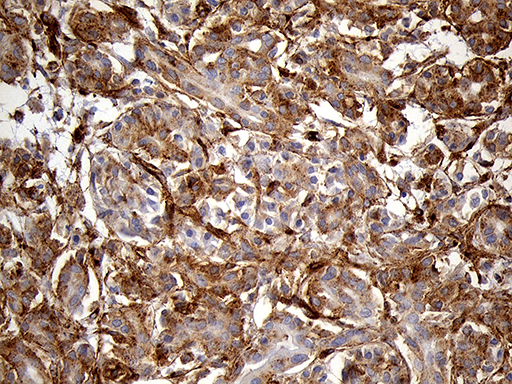 IFITM2 Antibody - Immunohistochemical staining of paraffin-embedded Human pancreas tissue within the normal limits using anti-IFITM2 mouse monoclonal antibody. (Heat-induced epitope retrieval by 1mM EDTA in 10mM Tris buffer. (pH8.5) at 120°C for 3 min. (1:2000)