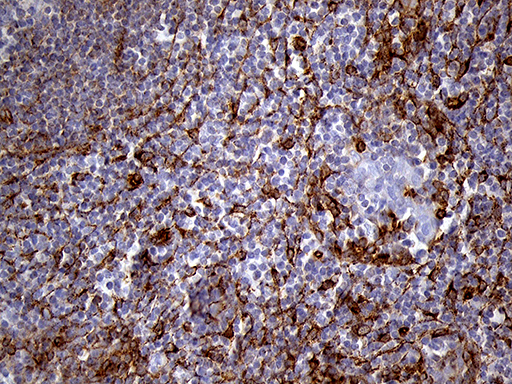 IFITM2 Antibody - Immunohistochemical staining of paraffin-embedded Human tonsil within the normal limits using anti-IFITM2 mouse monoclonal antibody. (Heat-induced epitope retrieval by 1mM EDTA in 10mM Tris buffer. (pH8.5) at 120°C for 3 min. (1:2000)