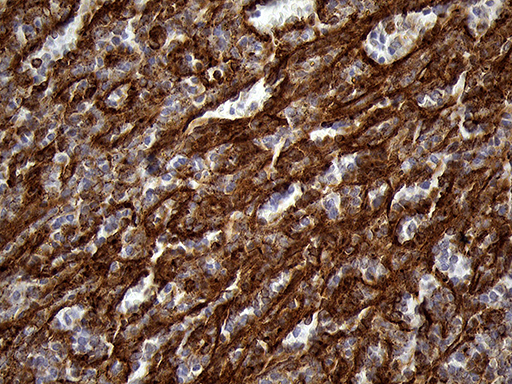 IFITM2 Antibody - Immunohistochemical staining of paraffin-embedded Human spleen tissue within the normal limits using anti-IFITM2 mouse monoclonal antibody. (Heat-induced epitope retrieval by 1mM EDTA in 10mM Tris buffer. (pH8.5) at 120°C for 3 min. (1:2000)