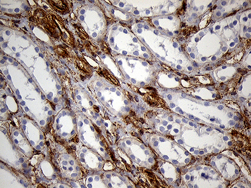 IFITM2 Antibody - Immunohistochemical staining of paraffin-embedded Human Kidney tissue within the normal limits using anti-IFITM2 mouse monoclonal antibody. (Heat-induced epitope retrieval by 1mM EDTA in 10mM Tris buffer. (pH8.5) at 120°C for 3 min. (1:2000)